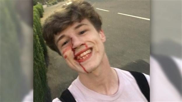 Un ragazzo scozzese, vittima dell’omofobia, risponde sui social all’aggressore con un bel sorriso: "Ti auguro ogni bene"