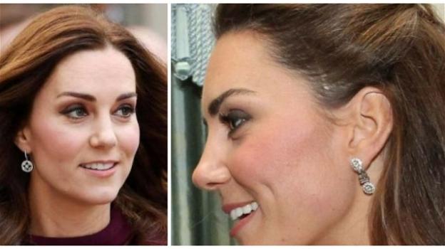 Kate Middleton, la cicatrice sulla testa svelata dai paparazzi preoccupa i sudditi: i chiarimenti di St. James Palace