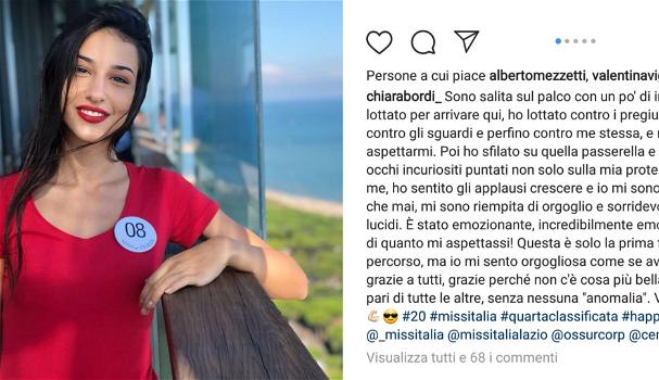 Chiara Bordi, la concorrente di Miss Italia insultata perché disabile: “Ti votano solo perché sei storpia”