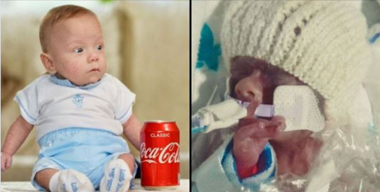 In Inghilterra è nato il bambino più piccolo di sempre: pesa quanto una lattina di Coca Cola