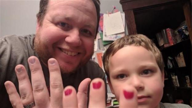 Bambino di 5 anni viene deriso per lo smalto sulle unghie. Il papà si dipinge le unghie per difenderlo