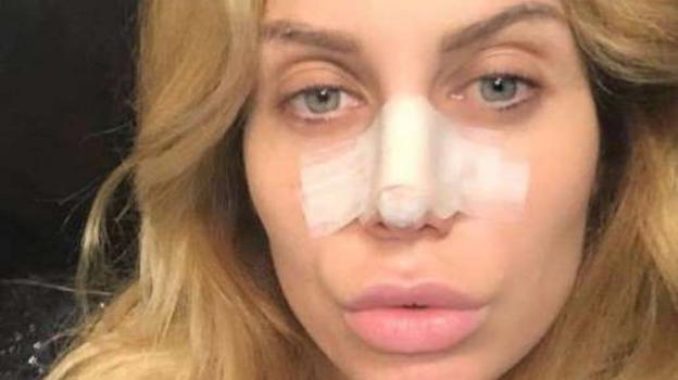 Paola Caruso, paura per l’ex Bonas di "Avanti un altro": operata d’urgenza dopo un piccolo incidente