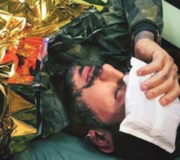Fabrizio Corona picchiato dai pusher a Rogoredo. È tutta una farsa? Un dettaglio non convince: “Sei un pagliaccio”