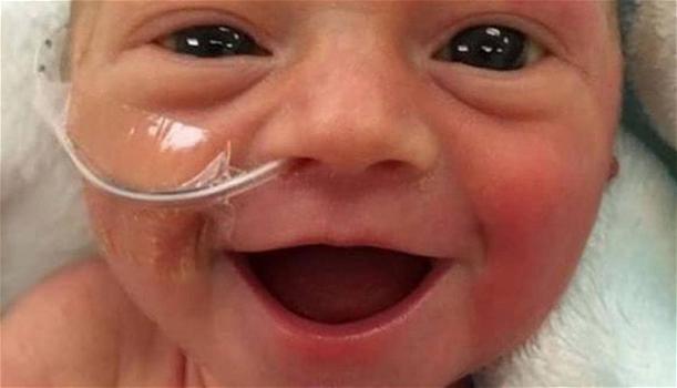 Questa bimba è nata prematura, il suo primo sorriso commuove il web