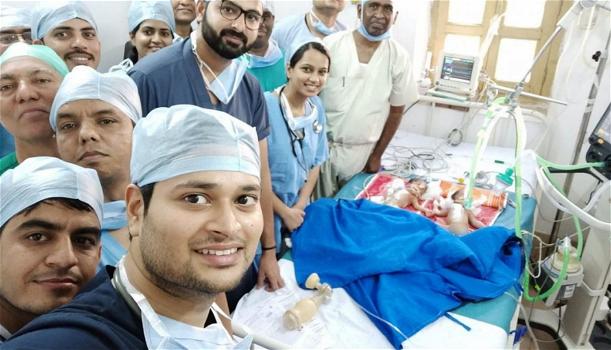 Separano due gemelle siamesi di soli 3 giorni: il selfie dei medici dopo l’intervento è virale