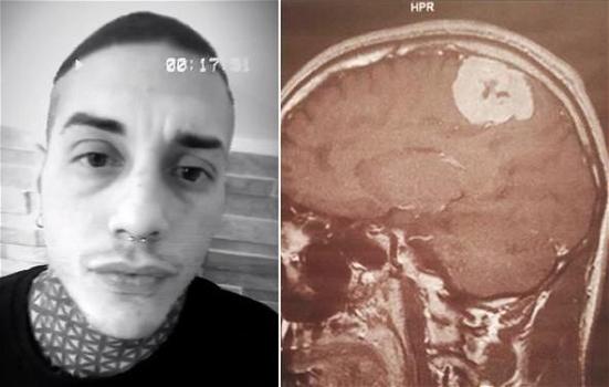 Francesco Chiofalo, l’annuncio shock: “Ho un tumore al cervello, non so se ce la farò”