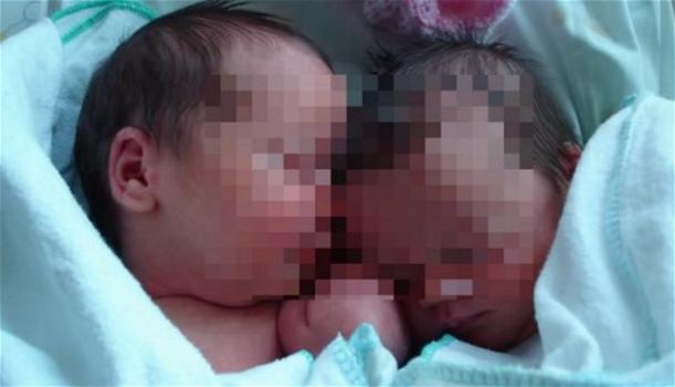 Andrea e Fabio, i gemelli da record: uno nato nel 2018 e l’altro nel 2019. L’amara verità