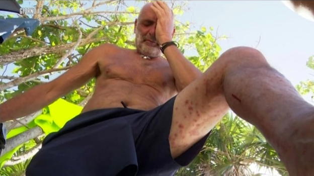 L’Isola dei Famosi, Paolo Brosio sofferente a causa dei mosquitoes lascia l’Isola per ricevere cure mediche