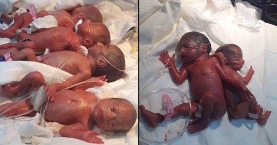 Madre 25enne dà alla luce 7 gemelli in un singolo parto naturale: è un record nazionale