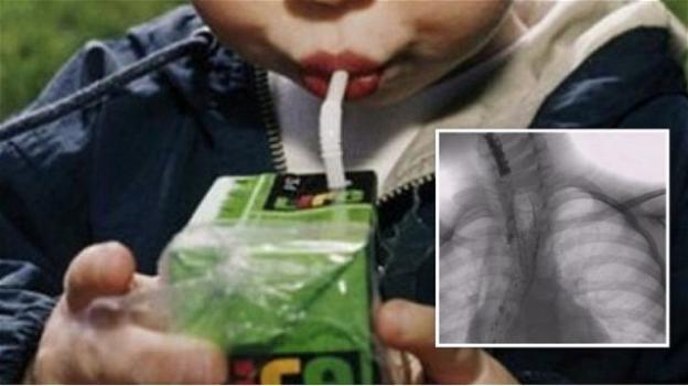 Acido caustico nel succo di frutta bevuto al bar: bimbo di 5 anni ricoverato