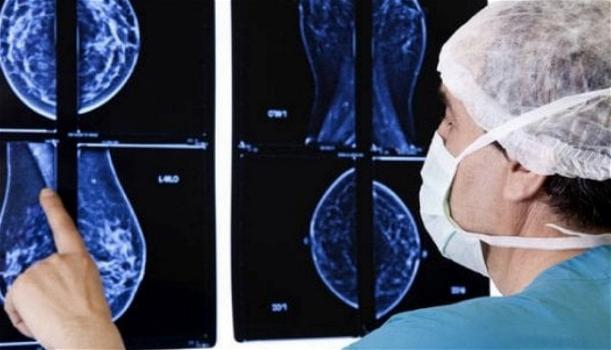Cancro al seno: scoperti i geni che predicono il rischio di metastasi