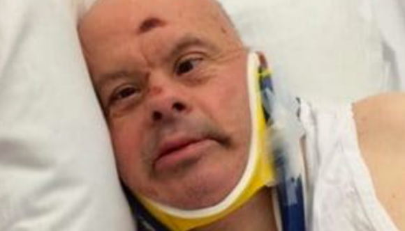 Il dramma di Giuseppe, lasciato morire senza cibo per 10 giorni in Ospedale: era affetto dalla sindrome di Down