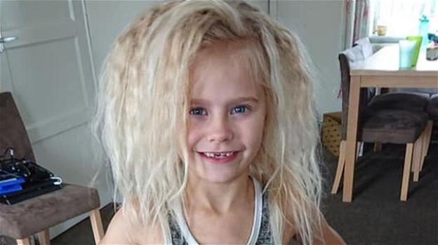 UK, la storia di Wynter Seymour la bambina dai capelli impettinabili come Albert Einstein