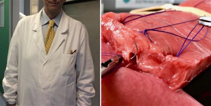 Denunciato ginecologo: si esercitava abusivamente praticando punti di sutura su pezzi di manzo
