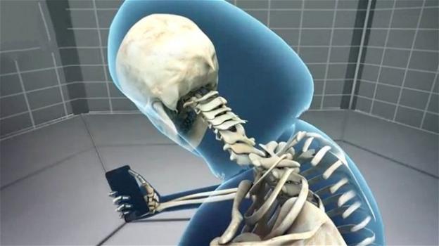 Usare troppo lo smartphone causa la formazione di un nuovo osso a forma di corno