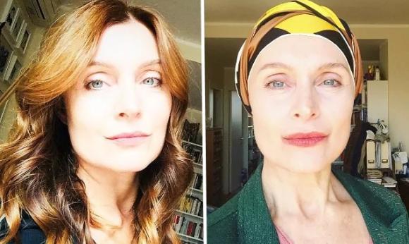 Sabrina Paravicini, Jessica di “Un Medico in Famiglia” attaccata dagli hater per la chemio