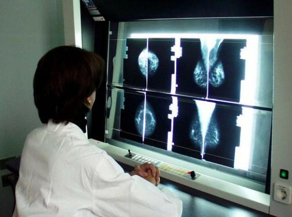 La scoperta di un fisico pugliese: tumori eliminati con fasci di elettroni