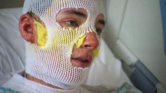 Giovane di 20 anni si getta tra le fiamme per salvare la nipotina: “Urlava il mio nome…”