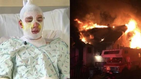 Giovane di 20 anni si getta tra le fiamme per salvare la nipotina: “Urlava il mio nome…”