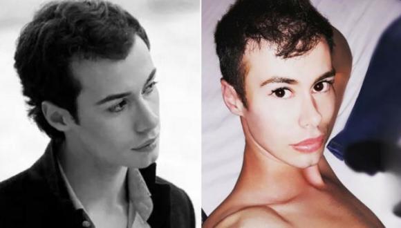 Il dramma di Angelo Sanzio: “Mi sono inguaiato per colpa della chirurgia”