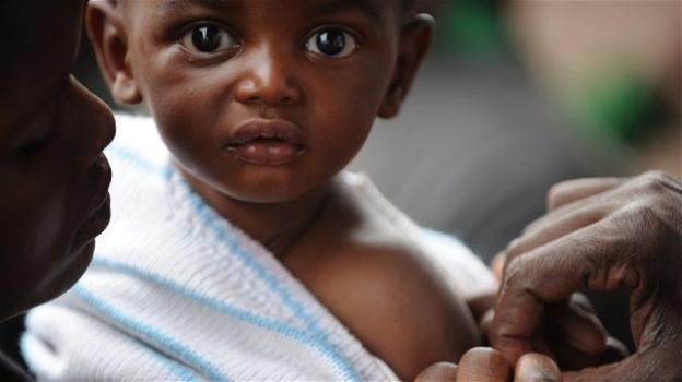 4000 morti per la più grande epidemia di morbillo in Congo