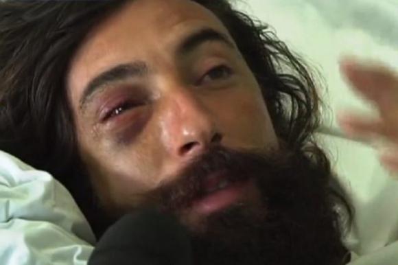 Striscia la Notizia, Brumotti di nuovo aggredito: sassaiola e lancio di bici durante un servizio