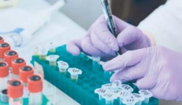 Sotto stress le cellule maschili vanno incontro al suicidio, quelle femminili resistono