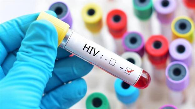 HIV: individuato un nuovo ceppo del virus