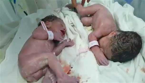 Terremoto in Albania, 20 minuti dopo la prima scossa nascono due gemellini: “La forza della vita”