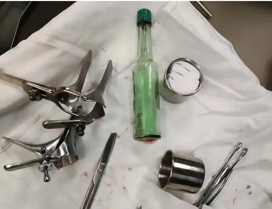 60enne si presenta in ospedale con una bottiglia nel retto: “Avevo un forte prurito”