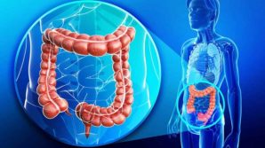 Mangiando più di 50 grammi al giorno di carni lavorate, si aumenta del 18% il rischio di tumore al colon-retto