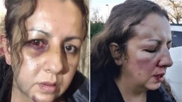 USA: mamma picchiata perché voleva denunciare gli atti di bullismo contro la figlia