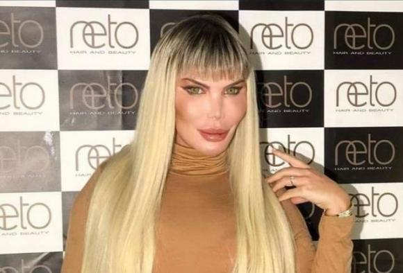 Il Ken umano diventerà la Barbie umana: l’ennesima trasformazione di Rodrigo Alves
