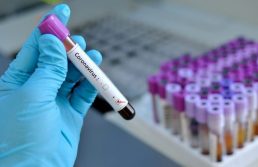 Coronavirus, mascherine sold out nelle farmacie di Roma