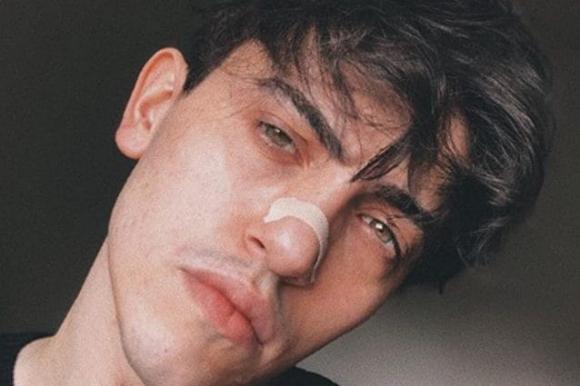 Verissimo, Michele Bravi torna a parlare in tv per la prima volta dopo l’incidente