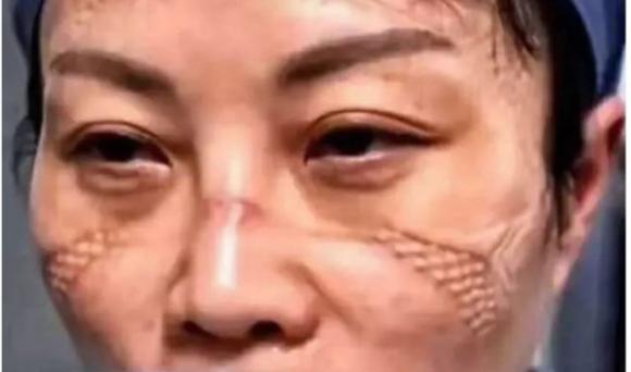 Coronavirus, le foto shock dei medici-eroi: sono feriti ed esausti