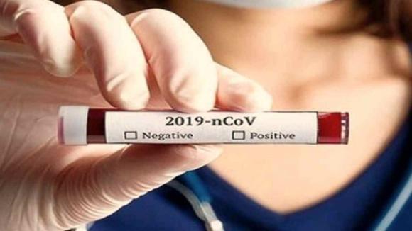Coronavirus: 60 nuovi casi sulla nave da crociera in Giappone. Salgono a 910 le vittime
