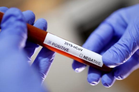 Nigeria: confermato il primo caso di coronavirus, è un italiano