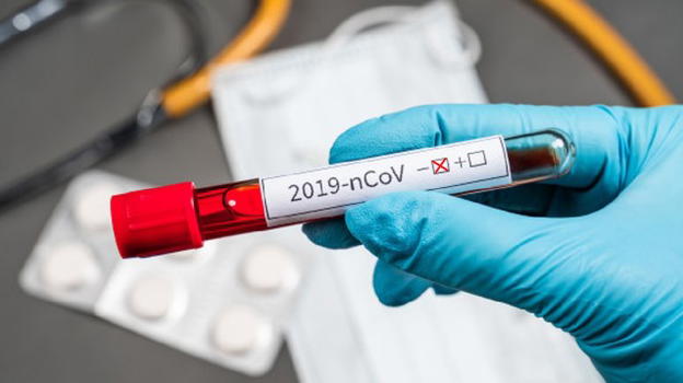 La sperimentazione dei farmaci anti-Coronavirus funziona