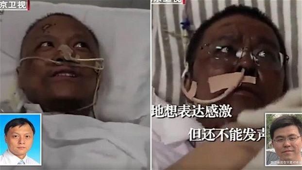 Coronavirus, medici cinesi contagiati si risvegliano con la pelle scura