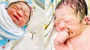 La spirale non ha funzionato e il bimbo nasce tenendola in mano, le foto sono virali