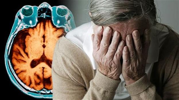 Alzheimer, un test ne permetterà la diagnosi con 20 anni d’anticipo