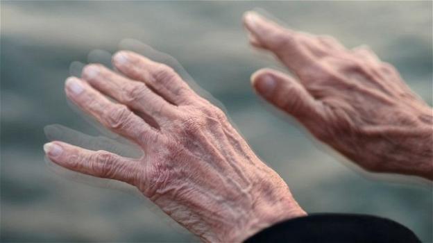 Uno studio australiano rivela che il Covid-19 potrà favorire l’insorgenza del Parkinson