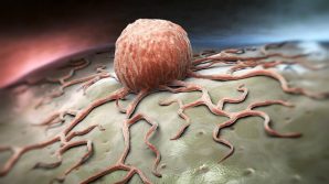In Europa guariscono dal tumore il 51% delle donne e il 40% degli uomini