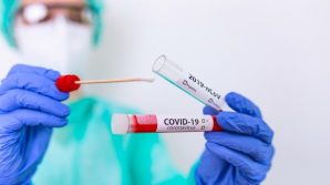 Uno studio francese lo conferma: il Covid è molto più grave dell’influenza
