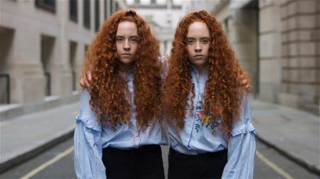 I gemelli omozigoti non sono geneticamente uguali