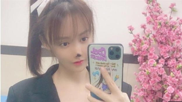 L’attrice cinese Gao Liu ha perso il naso dopo un intervento di chirurgia estetica