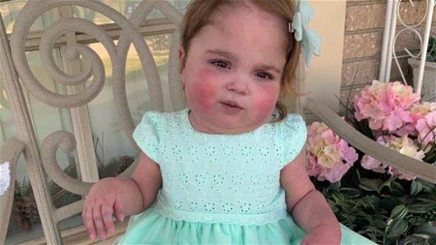 USA: Valentina Garnetti, 2 anni, lascia l’ospedale dopo 694 giorni di ricovero