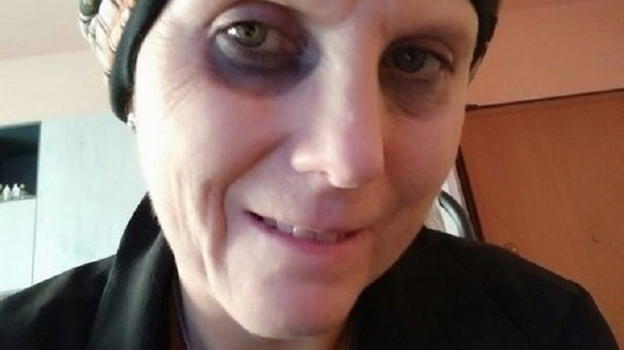 Malata di tumore: madre naturale accetta test, speranza di cura per Daniela Molinari
