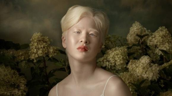 Abbandonata da neonata perché albina, oggi Xueli è modella per Vogue